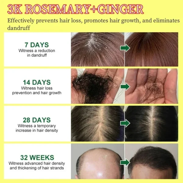 Serum Anti Hair loss- Treatment For Women Men - Image 5