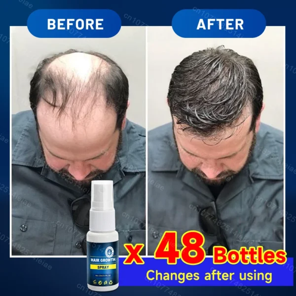 Soins capillaires Biotin Hair Growth Serum Anti Hair Loss