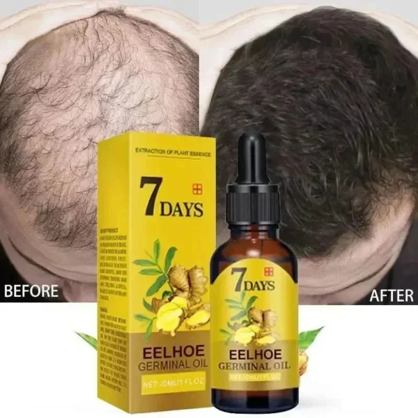 Serum Anti Hair loss- Treatment For Women Men - Image 2