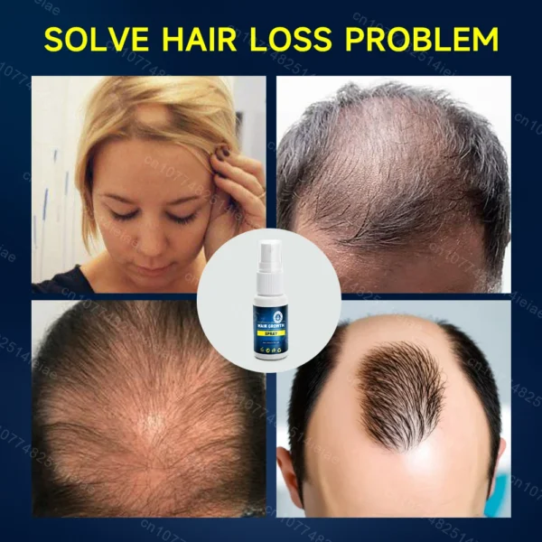 Soins capillaires Biotin Hair Growth Serum Anti Hair Loss - Image 2