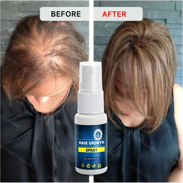 Soins capillaires Biotin Hair Growth Serum Anti Hair Loss - Image 5